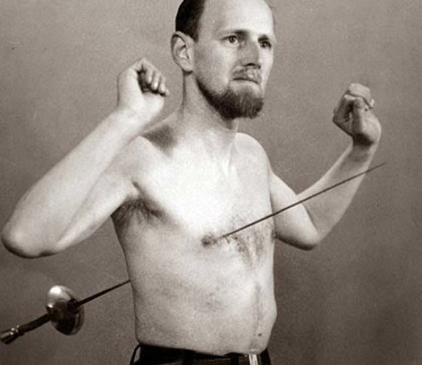 Mirin Dajo made his sideshow debut in 1947. He commanded the attention of the crowd by allowing his assistant to impale him with a sword without so much as a wince. 

This bizarre talent not only captured the attention of sideshow attendees but also professionals in the medical field. He was invited to display his talents at a medical center, and X-rays were produced to prove the authenticity of his act. However, even a medical marvel has limits—Dajo's unique gift was also responsible for his demise. He died at the age of 35 after ingesting a large needle, which led to an aortic rupture. 

The Human Pincushion remains a marvel and continues to puzzle those in the medical field to this very day.