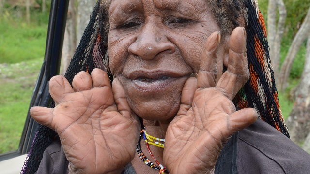 The Dani people of Western New Guinea have a unique mourning process. It's fallen somewhat out of practice, but it was traditional for older women to cut off segments of their finger to show their mourning after the death of a loved one.