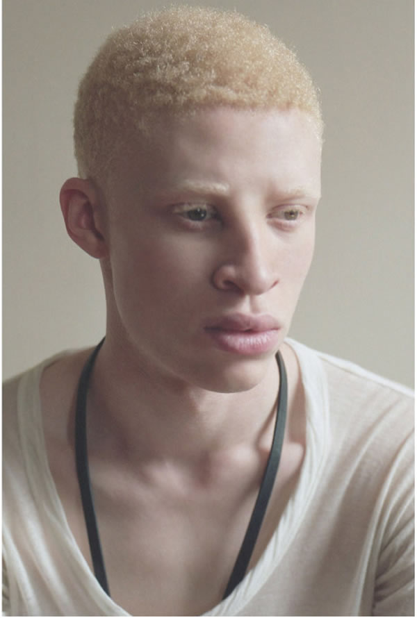 Shaun Ross, born and raised in the Bronx, is a professional fashion model, actor and dancer best known for being the first male albino model. After training at the Alvin Ailey School for five years, Ross was discovered on YouTube and crossed over to the fashion industry in 2008 at just 16 years old.

He has been featured in photo-editorial campaigns in fashion publications including British GQ, Italian Vogue, i-D Magazine, Paper Magazine and Another Man. He has modeled for Alexander McQueen and Givenchy, and recently became the face of Ford Vehicles. The company's slogan? "Be Unique."