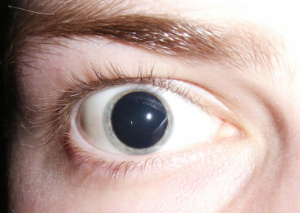 Even small noises can make your pupils dilate.