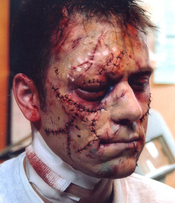 While most horror makeup shows people bloody and gory as if they were just victimized, this nightmarish creation shows someone who has already been treated at the hospital for their wounds. This look by Ken Hertlein is more about the story of what happened yesterday rather than what just happened.