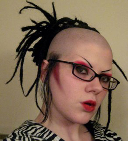 17 People Who Decided to Own Their Baldness