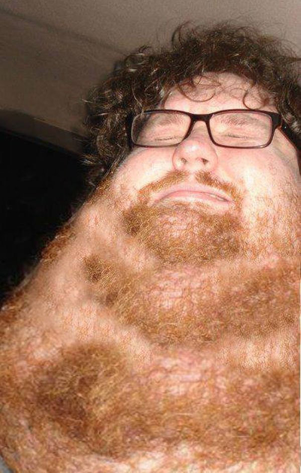 gross neck beard.