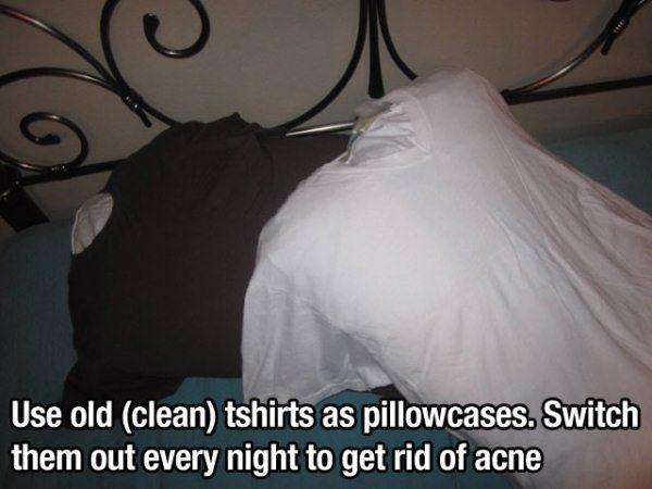 knight frank - Use old clean tshirts as pillowcases. Switch them out every night to get rid of acne