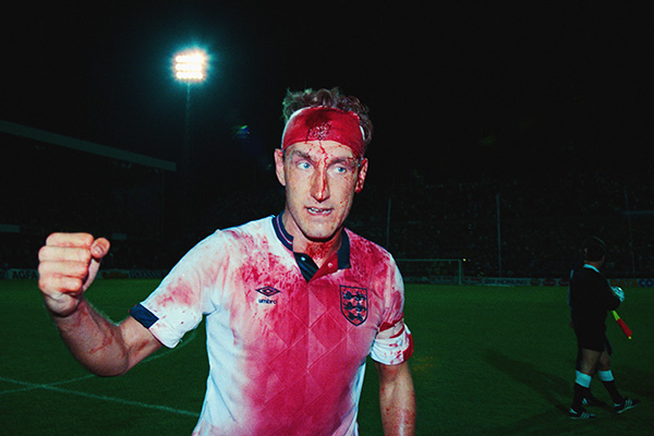 Scrapes and cuts aren't unusual in soccer, where you can't use your hands to deflect a ball coming your way. However, during a 1990 World Cup qualifying match against Sweden, one of England's most vital defenders Terry Butcher suffered a ghastly cut to his head in the first few minutes. He stepped to the sidelines to let the team's doctor quickly stitch it up and was back on the pitch soon after. But a large number of high balls could only be repelled by Butcher's head, swiftly re-opening the wound and causing gobs of blood to gush over his face and jersey. It wasn't life-threatening, but by the end of the game Butcher looked like his namesake and England held Sweden to a 0-0 tie.