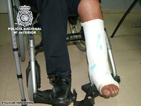 A man in a wheelchair with a broken leg was attempting to smuggle 11 pounds of cocaine from Chile to Barcelona. Authorities not only discovered the drug hidden in a 6-pack of beer, and in two hollowed-out stool legs, but also in his cast. In fact, his cast was made ENTIRELY out of cocaine. A chemical applied to the cast made it turn blue, which indicated the illegal drug. 

Authorities suspect that the man purposely broke his leg in case they tried to x-ray him and also to add a little sympathy for his plight.
