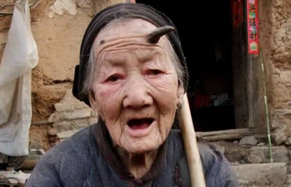 A 101-year-old woman in China has surprised her relatives by growing a six-centimeter-long horn from her forehead—and it looks like another one may be sprouting on the other side of her head.

Centenarian Zhang Ruifang, of Linlou Village in China's Henan Province, first started developing the strange growth in 2009, when a patch of rough skin appeared on the left side of her forehead. Her youngest son, 60-year-old Zhang Guozheng, said that when the growth first appeared they "didn't pay too much attention to it. But as time went on, a horn grew out of her head." The condition has left her family worried—especially now that it seems that she is developing a second horn on the right side of her forehead to match the first.