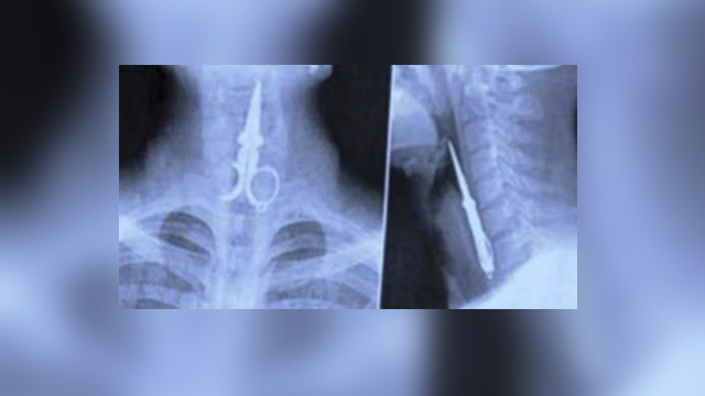 15 Photos Of X-Rays That Will Make You Say WTF