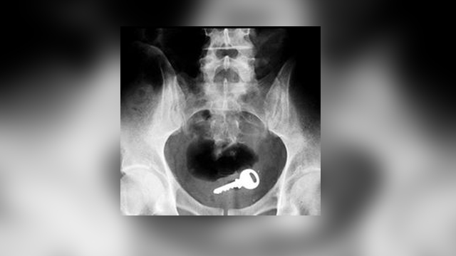 15 Photos Of X-Rays That Will Make You Say WTF
