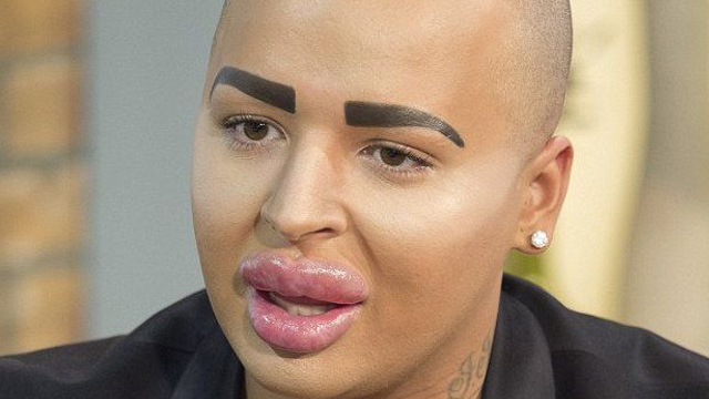 Jordan James Parke is a makeup artist that did everything he could to look like a male Kim Kardashian. He even went on the popular E! show 'Botched' asking to get even more plastic surgery.