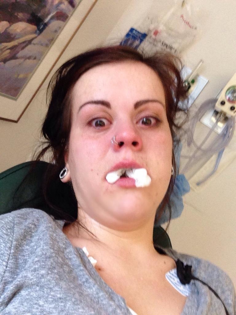 "Had oral surgery yesterday. Woke up this morning and found this in my phone."