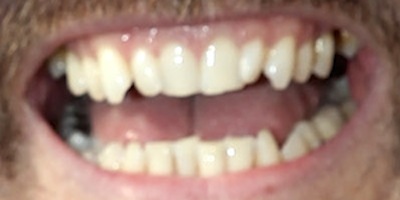 Which famous celeb do these horrible teeth belong to?
