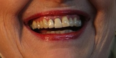 Which famous celeb do these horrible teeth belong to?