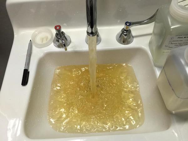 In April 2014, Flint, Michigan's drinking water became contaminated with lead while the city was under the control of a state-appointed emergency manager. As a cost-cutting move, city officials began drawing its water from the Flint River and treating it at the city water treatment plant while it waited for a new water pipeline to Lake Huron to be completed.

The state's Department of Environmental Quality has conceded it failed to require needed chemicals to be added to the corrosive river water. As a result, lead leached from pipes and fixtures into the drinking water.

Michigan's chief medical executive, Eden Wells, says that the children in Flint (8,657) who drank the city's water since April 2014 have been exposed to lead. That may be a low estimate — it doesn't include unborn children whose mothers drank tainted water during their pregnancies, or children and pregnant women who reside outside Flint but were exposed while visiting relatives, childcare centers or hospitals inside city limits. (There is no safe level of lead in the body for anyone, but the impacts of lead are considered most severe on the developing brains and nervous systems of children and fetuses.)

On January 5, 2016, Governor Rick Snyder declared a state of emergency in the area. A week later, he mobilized the National Guard to assist with distribution of bottled water and water filters. Although Flint switched back to Detroit water in October 2015, the danger remains because of damage the Flint River water did to the distribution system. 

President Obama declared a federal state of emergency in Flint on January 16, 2015 and has allocated $5 million in aid to the area.
