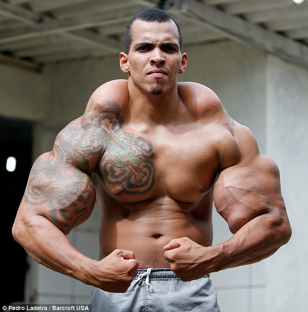 Romario Dos Santos Alves always wanted to be a body builder, and he modelled himself on his favorite superhero – the Incredible Hulk. To achieve this, he started injecting synthol, a mixture of alcohol and oil that accumulates under the skin, giving the appearance of muscle, but it didn’t go as well as he had hoped…