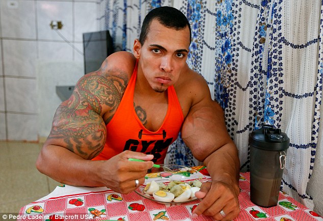 Soon, normal needles wouldn’t do the trick anymore. “My muscles started to solidify and I couldn’t even inject my arms – they were full of rocks,” he claims.

Romario needed bigger needles, the kind that vets use on bulls, to get the synthol in.