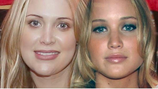 celebrities who went too far with plastic surgery