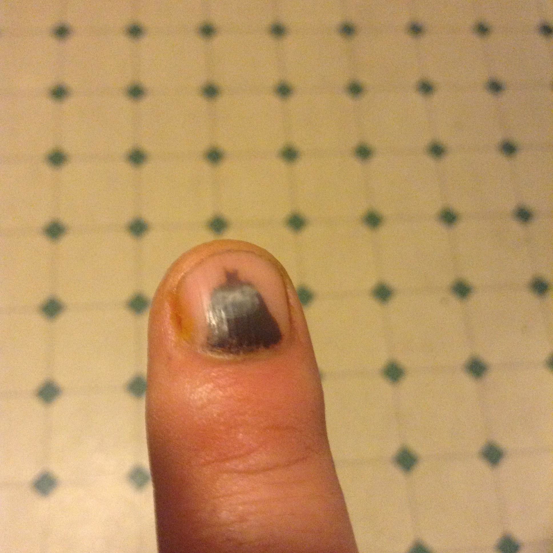 When Batman shows up on your smashed fingernail.