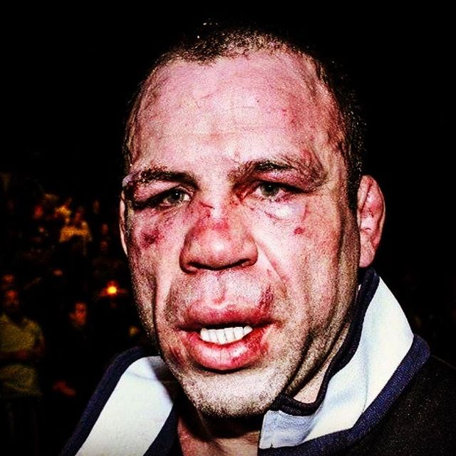 Wanderlei Silva after his fight with Chuck Liddell in 2007