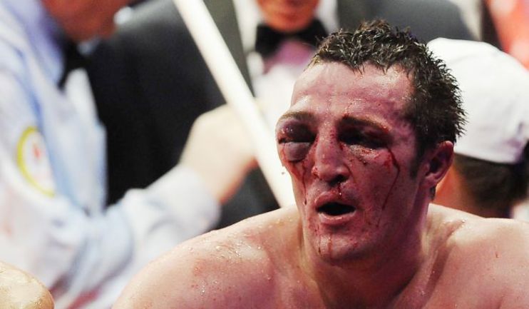 Dennis Lebedev's face after brutal fight with Guillermo Jones