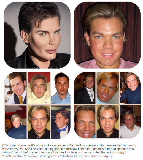 A Man Who Is Turning Himself Into A Human Ken Doll