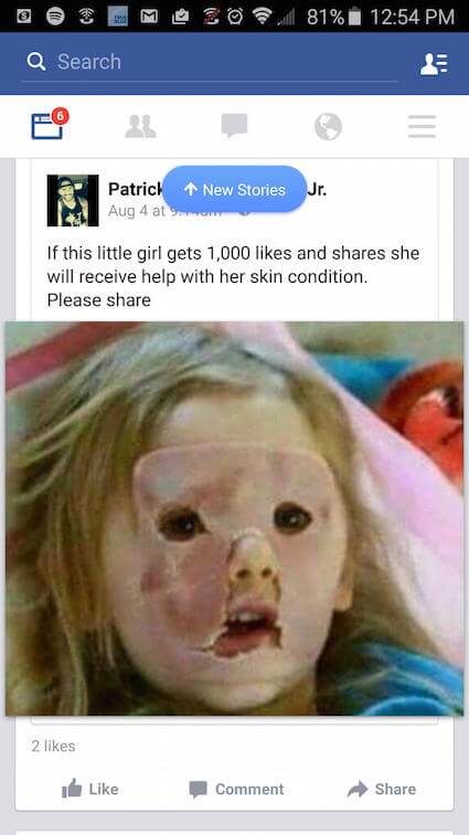 girl with ham on her face - Osmoso 81% Q Search New Stories Jr. Patrick Aug 4 at If this little girl gets 1,000 and she will receive help with her skin condition. Please 2 de Comment