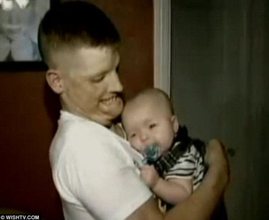 After the tragedy, Hunter was heartbroken to realize that his infant son was afraid of him and his injuries.