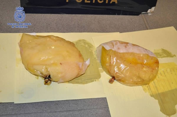 In 2014, a Venezuelan woman with 1.7kg of cocaine hidden in her breast implants was arrested at Madrid airport after arriving on a flight from Colombia.

"During a check of passengers on a plane from Bogotá, the gestures, and behavior of a supposed tourist raised the suspicions of narcotics agents," police said.

After a baggage search had revealed nothing, female officers conducted a body search of the 43-year-old woman and discovered "certain irregularities and deformations in both breasts." At that moment, the suspect confessed that she was carrying implants with cocaine inside.

The woman was taken to a hospital where the implants were removed and found to contain 1.7kg (3.75lb) of the drug.