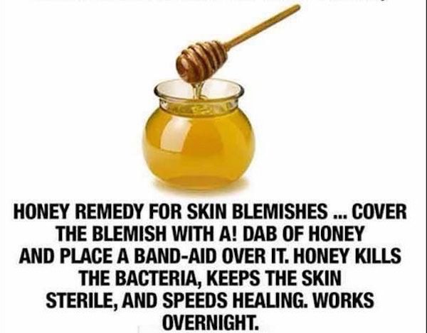 honey - Honey Remedy For Skin Blemishes ... Cover The Blemish With A! Dab Of Honey And Place A BandAid Over It. Honey Kills The Bacteria, Keeps The Skin Sterile, And Speeds Healing. Works Overnight.