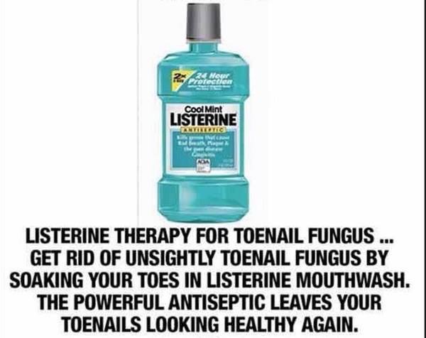 Prete Cool Mint Listerine Nyike Yg Listerine Therapy For Toenail Fungus ... Get Rid Of Unsightly Toenail Fungus By Soaking Your Toes In Listerine Mouthwash. The Powerful Antiseptic Leaves Your Toenails Looking Healthy Again.