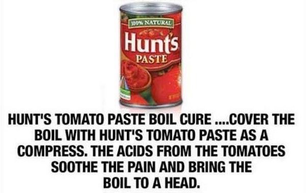 hunts tomato - Dow Natural Hunts Paste Hunt'S Tomato Paste Boil Cure ....Cover The Boil With Hunt'S Tomato Paste As A Compress. The Acids From The Tomatoes Soothe The Pain And Bring The Boil To A Head.