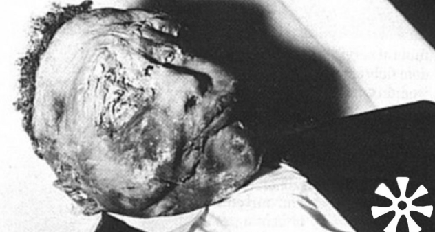 14 year old Emmett Till funeral photo after his lynching in Mississippi Chicago, IL 1955