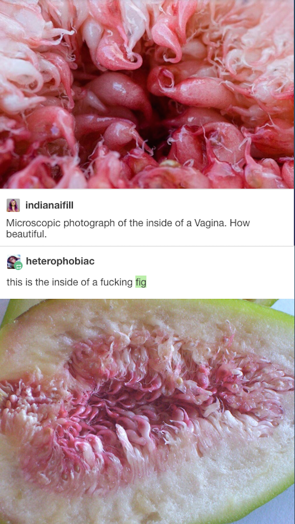 people getting called out  - vagina under microscope - indianalfill Microscopic photograph of the inside of a Vagina. How beautiful heterophobiac this is the inside of a fucking fig