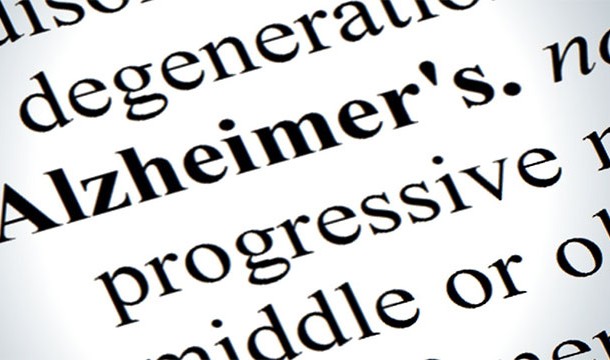 11SUI degenerall Alzheimer's. no progressive middle or o Det