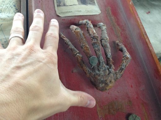 preserved human hand