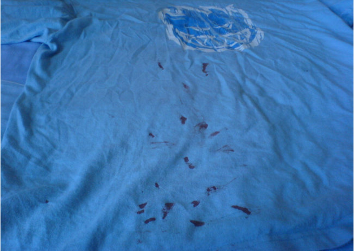 Pour some Coke on a blood-stained shirt to lift the red marks quickly.