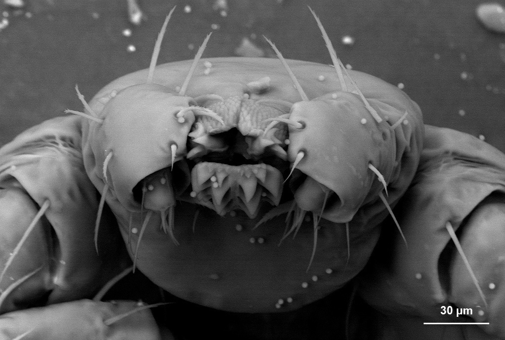 We all have mites in our eyelashes which embed their heads into your hair follicles.