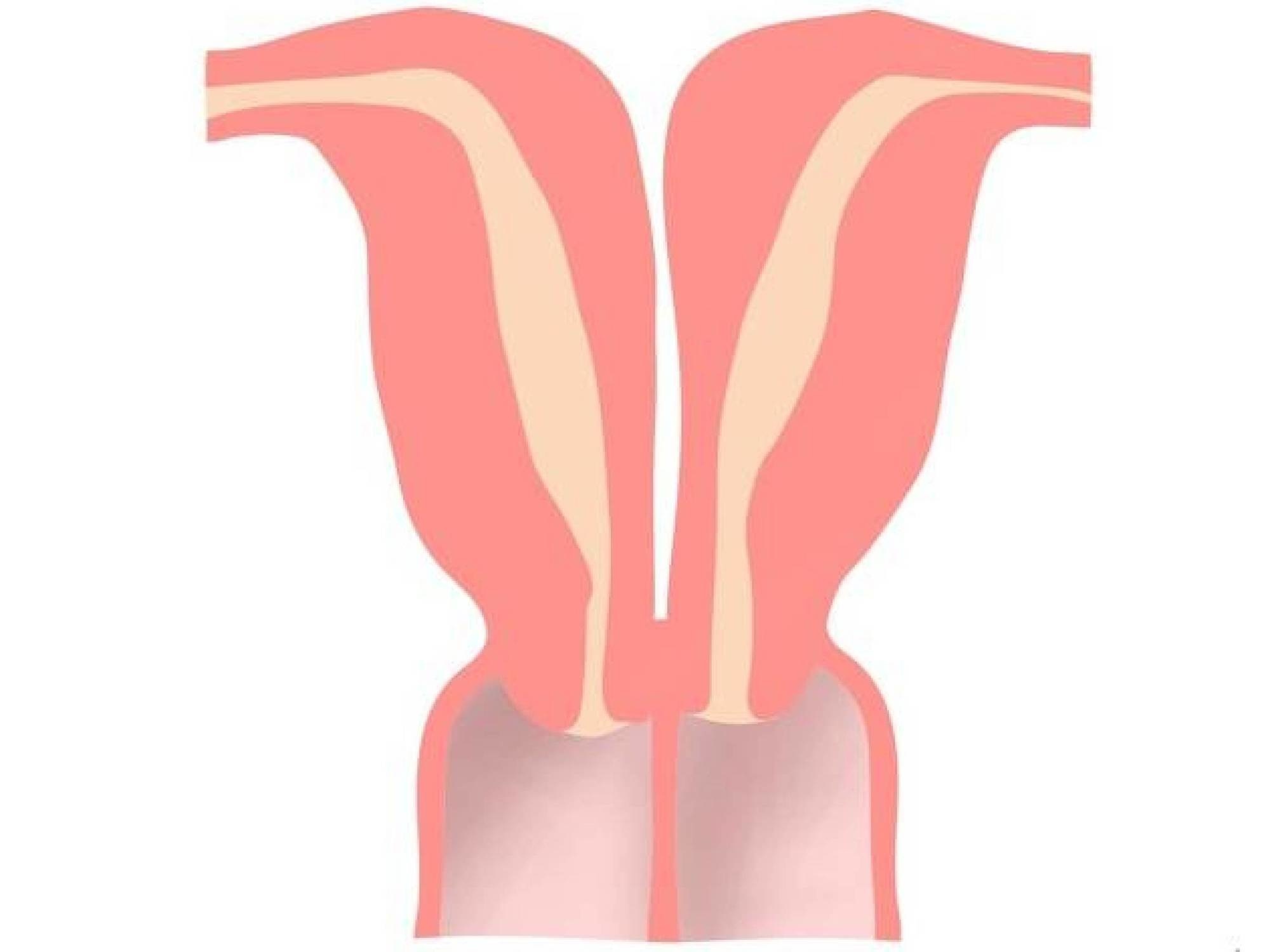 Aright, so now that you've got a handle on the one vagina thing, here's what it's like to have two.

The condition is known as uterus didelphys, and one Redditor claims that she has it -- and also took the time to explain what it means