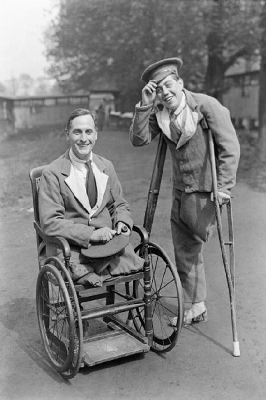 Amputation was a popular practice during WWI when soldiers were wounded.
Patients limbs were surgically removed instead of removing bullets to avoid infection and excessive bleeding.
