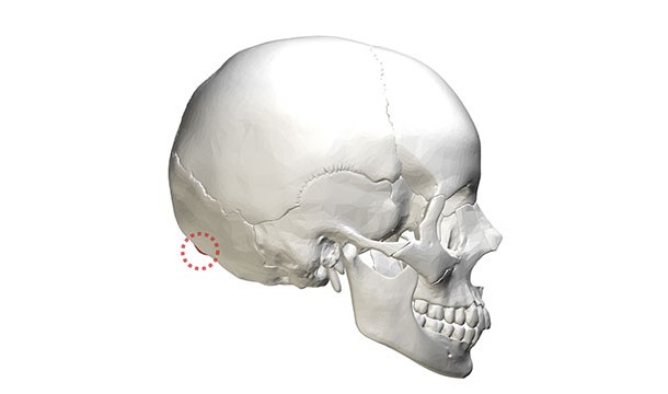 The external occipital protuberance (the bump on the back of your skull) is bigger in males than in females.