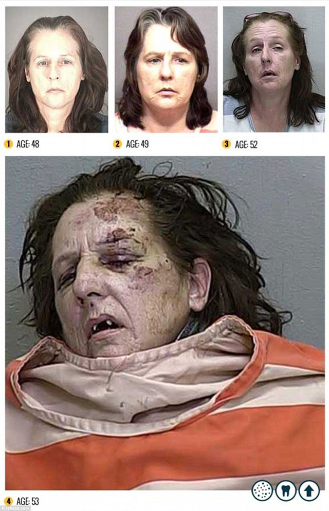 the faces of meth