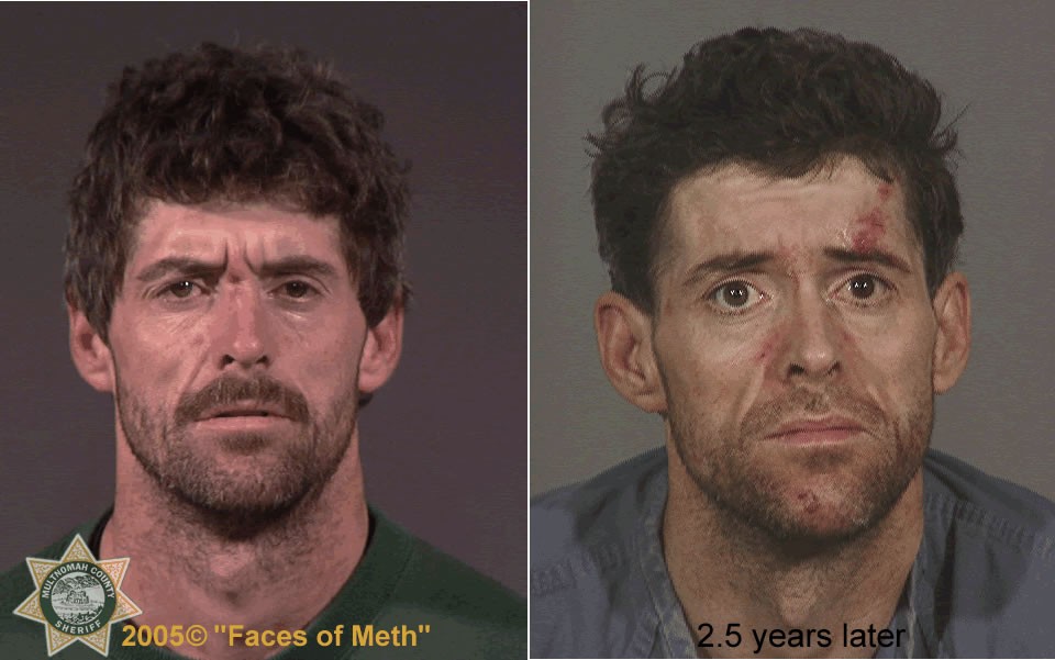 the faces of meth