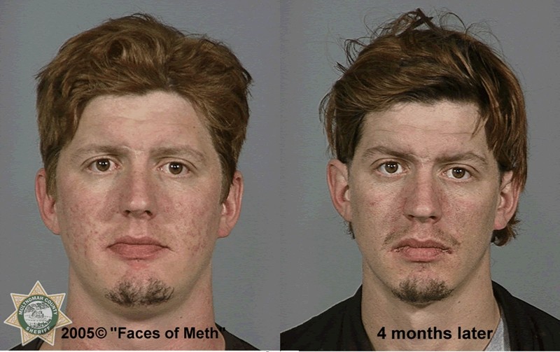 the faces of meth