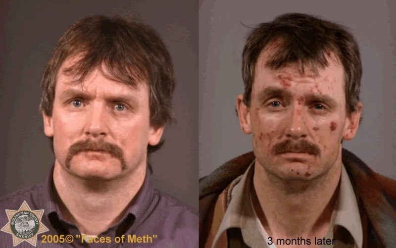 the faces of meth