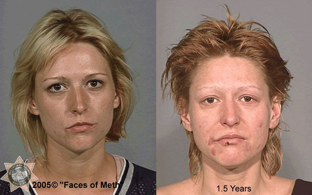 the faces of meth