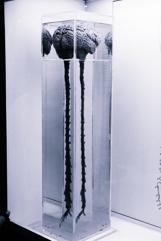 Brain and spinal cord