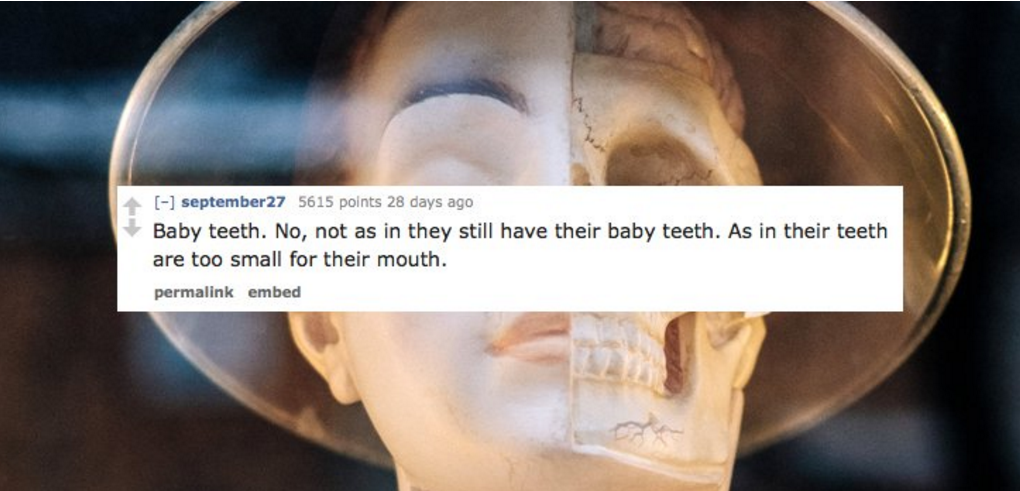 photo caption - points 28 days ago Baby teeth. No, not as in they still have their baby teeth. As in their teeth are too small for their mouth. permalink embed