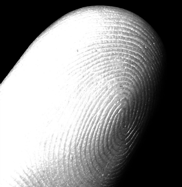 Fingerprints are becoming more and more important in our digital world as we increasingly use them to verify our identity on phones, and banks, hospitals, and airports. Unfortunately, some cancer drugs (most notably Capecitabine) have the side effect of hand-foot syndrome, which can result in vanishing fingerprints. Doctors warn those taking Capecitabine to travel with a physician's note to help clarify their situation.