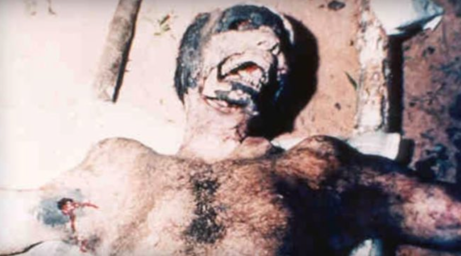 In 1994, a man was found dead and mutilated in Brazil. Many of his internal organs had been removed through holes in his chest.
It is believed that the man was alive when his organs were removed, and that he ultimately suffered a heart attack caused by extreme pain and shock. Medical examiners also concluded that the man's organs had been sucked out of his body with some type of vacuum-like machine. Among the parts missing were his left eye, left ear, and lips. His body was also completely drained of blood.

Considering the tools, knowledge, and efficiency that a harvest like this would have taken, many believe the man was the victim of extraterrestrials performing human body experiments.