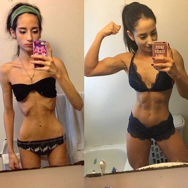 From anorexic to fit and healthy